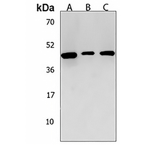 ANKRD40 Rabbit Polyclonal Antibody