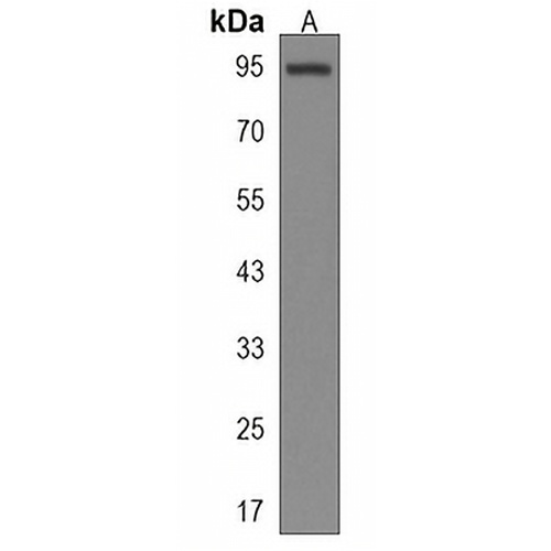 PTCHD4 Rabbit Polyclonal Antibody