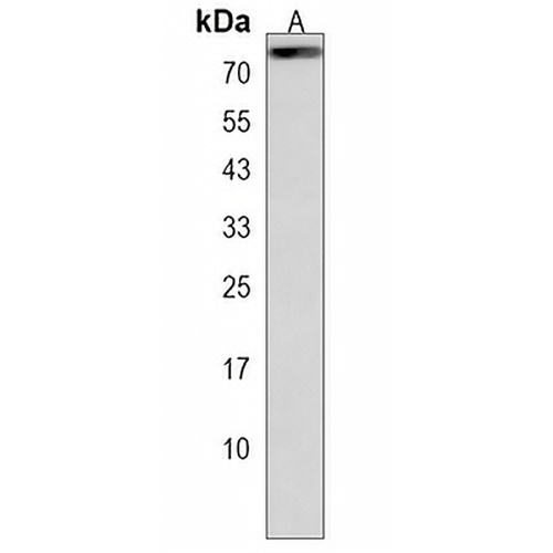 ZNF648 Rabbit Polyclonal Antibody