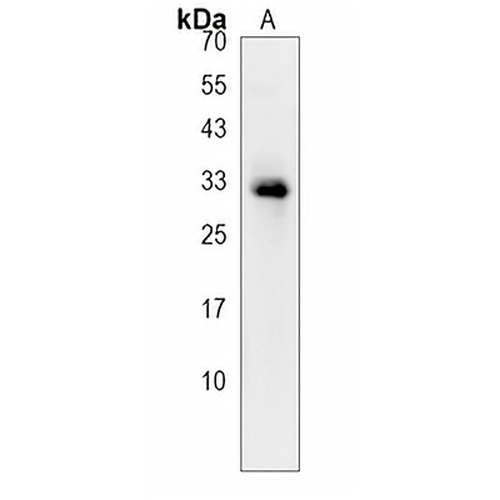 OR2B11 Rabbit Polyclonal Antibody