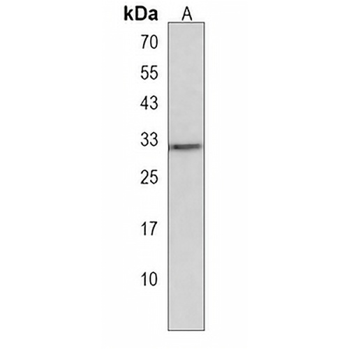 OR5B12 Rabbit Polyclonal Antibody