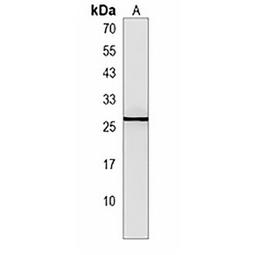 p23 Rabbit Polyclonal Antibody