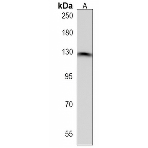 DDX60L Rabbit Polyclonal Antibody