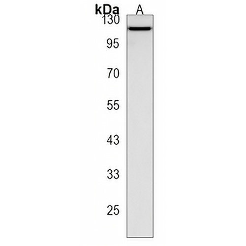 ECT2L Rabbit Polyclonal Antibody