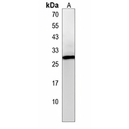 HIDE1 Rabbit Polyclonal Antibody