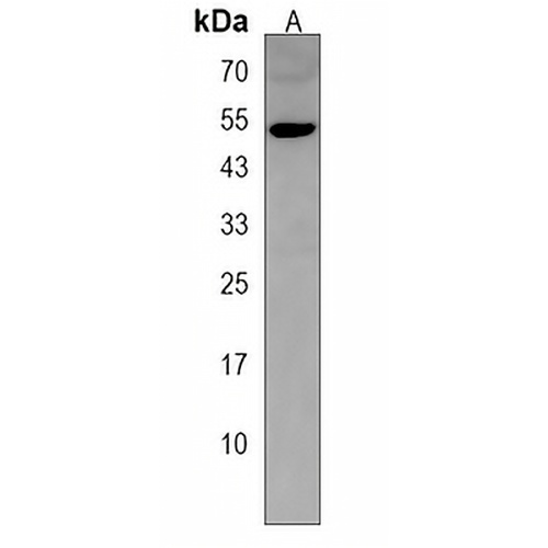 TTC23L Rabbit Polyclonal Antibody