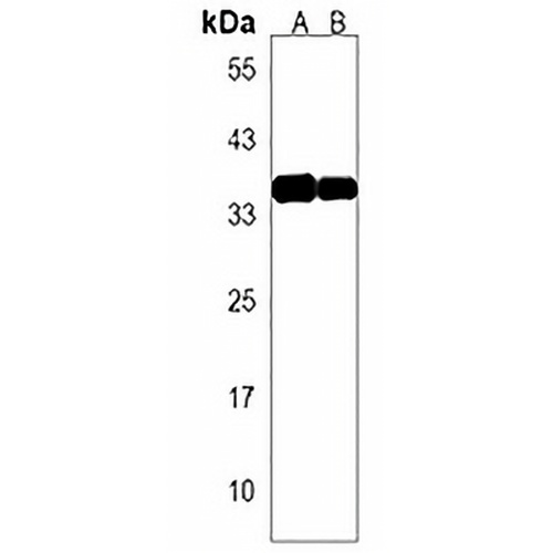 OR7G1 Rabbit Polyclonal Antibody