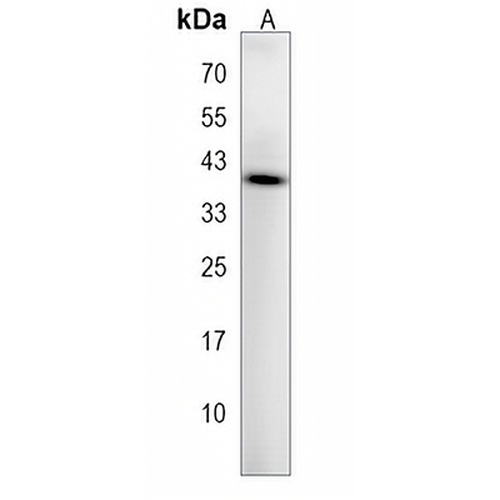 CD85f Rabbit Polyclonal Antibody