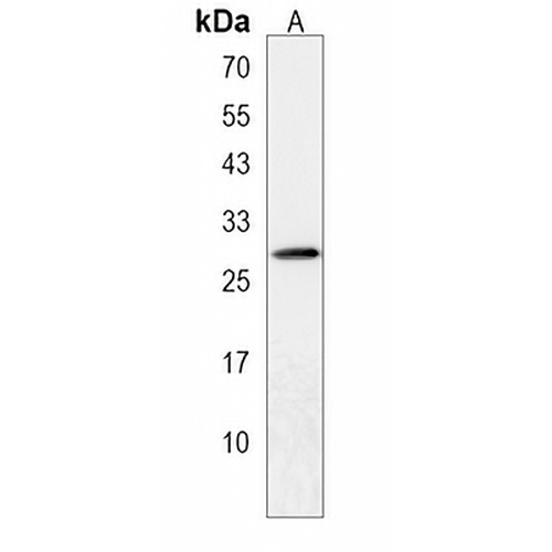 JAZF1 Rabbit Polyclonal Antibody
