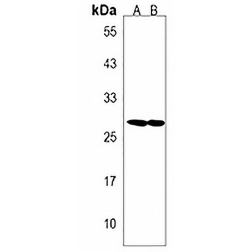 SPATS1 Rabbit Polyclonal Antibody