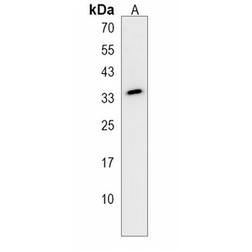 STARD6 Rabbit Polyclonal Antibody