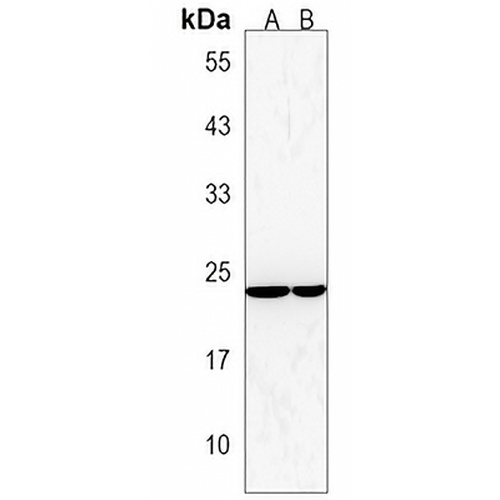 FRAT2 Rabbit Polyclonal Antibody