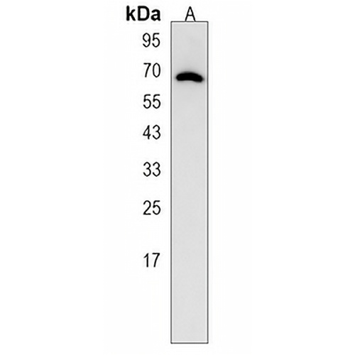 Collagen 13 alpha 1 Rabbit Polyclonal Antibody