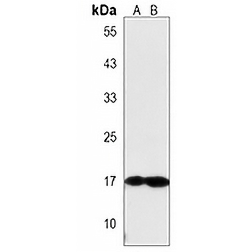 FGF16 Rabbit Polyclonal Antibody