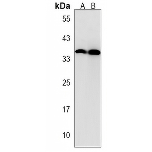 GPM6B Rabbit Polyclonal Antibody