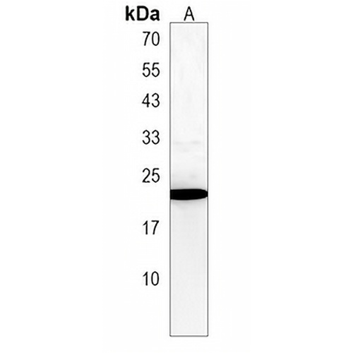 CT45A3 Rabbit Polyclonal Antibody