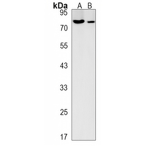 ZBTB24 Rabbit Polyclonal Antibody