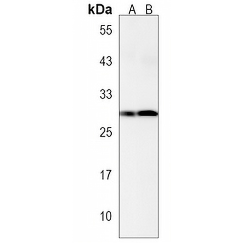 PABPN1L Rabbit Polyclonal Antibody