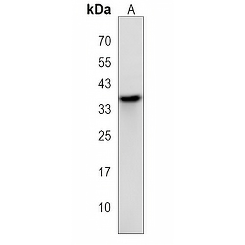 OR2AT4 Rabbit Polyclonal Antibody