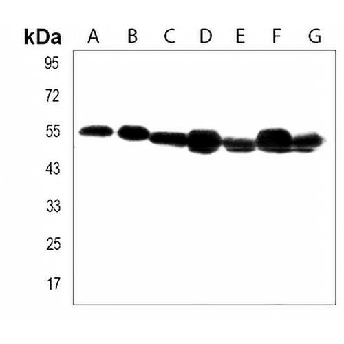 TUBB6 Rabbit Polyclonal Antibody