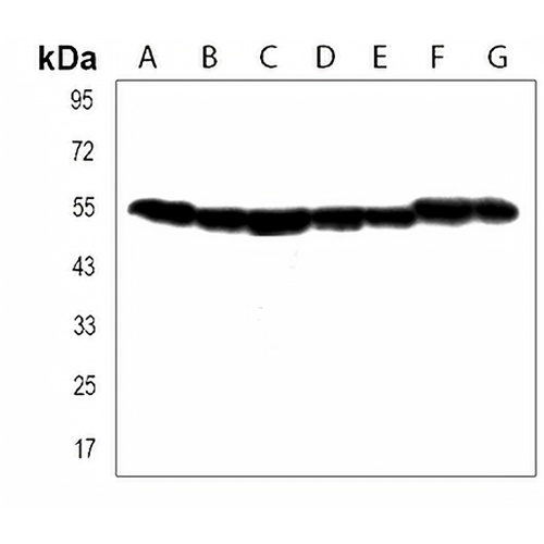 TUBB2B Rabbit Polyclonal Antibody