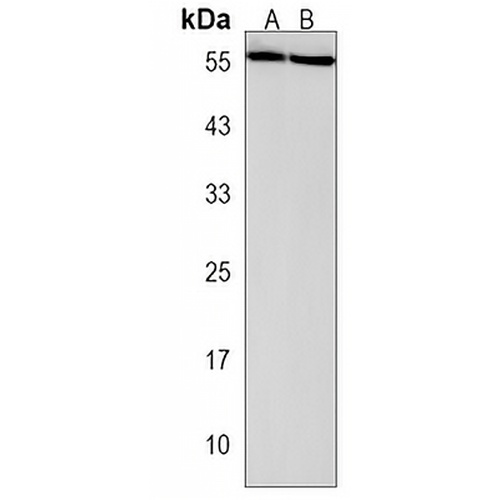 SmgGDS Rabbit Polyclonal Antibody