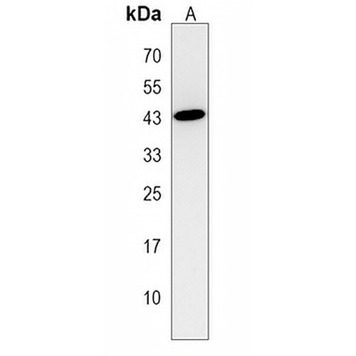 MOGAT3 Rabbit Polyclonal Antibody