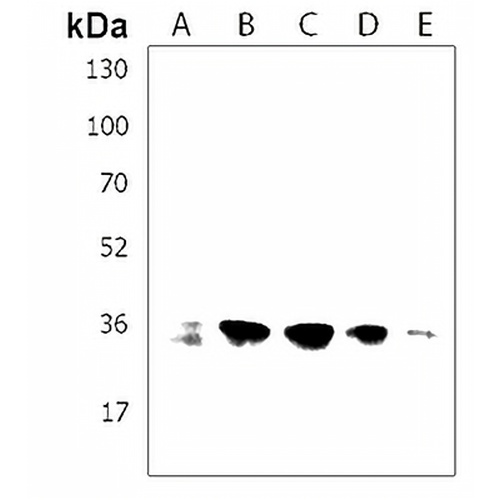 PPP1R3G Rabbit Polyclonal Antibody