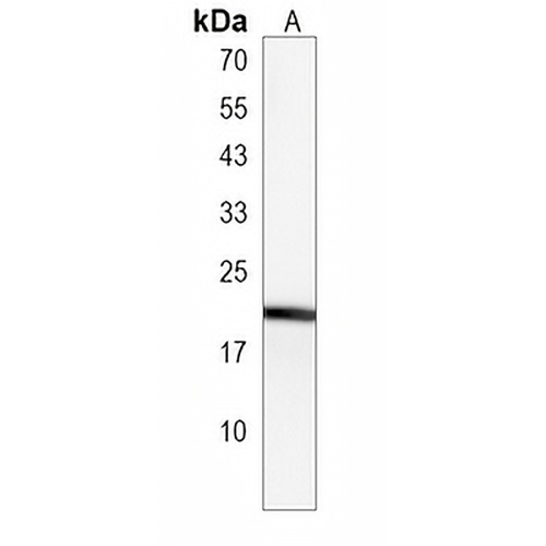 RBPMS2 Rabbit Polyclonal Antibody