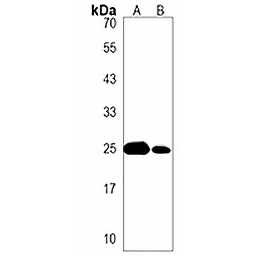 SDHD Rabbit Polyclonal Antibody