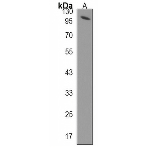 TAF4B Rabbit Polyclonal Antibody