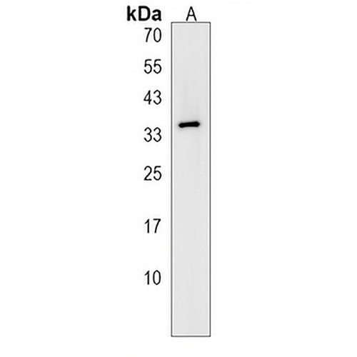 OR51Q1 Rabbit Polyclonal Antibody