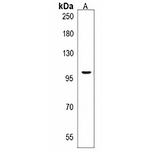ZNF845 Rabbit Polyclonal Antibody