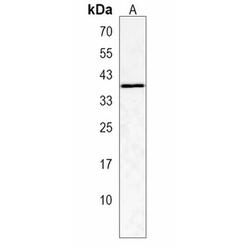 ARRDC5 Rabbit Polyclonal Antibody