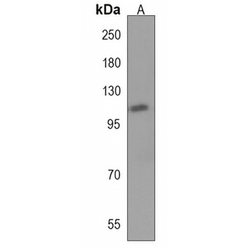 HIPK1 Rabbit Polyclonal Antibody