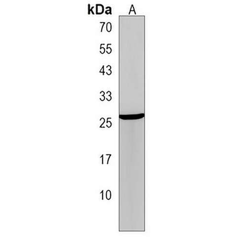 WFDC1 Rabbit Polyclonal Antibody