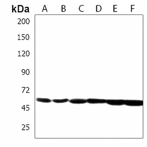 DUS1L Rabbit Polyclonal Antibody