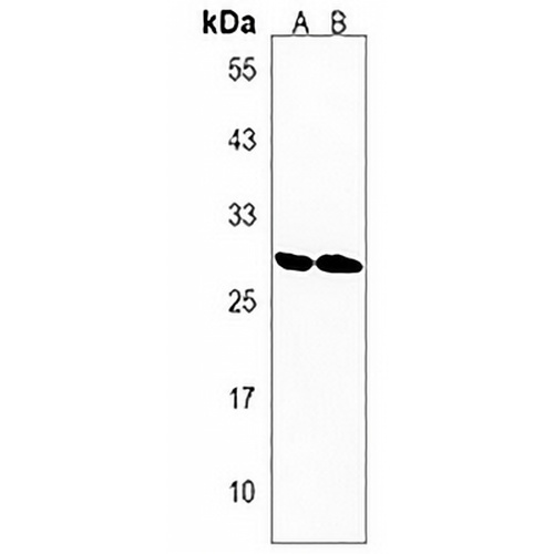 DHRS4L1 Rabbit Polyclonal Antibody