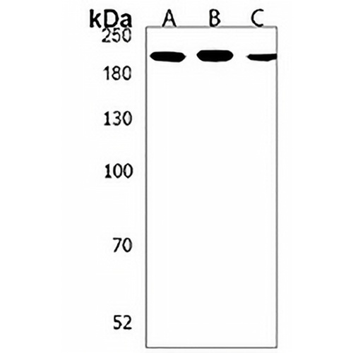 PREX1 Rabbit Polyclonal Antibody