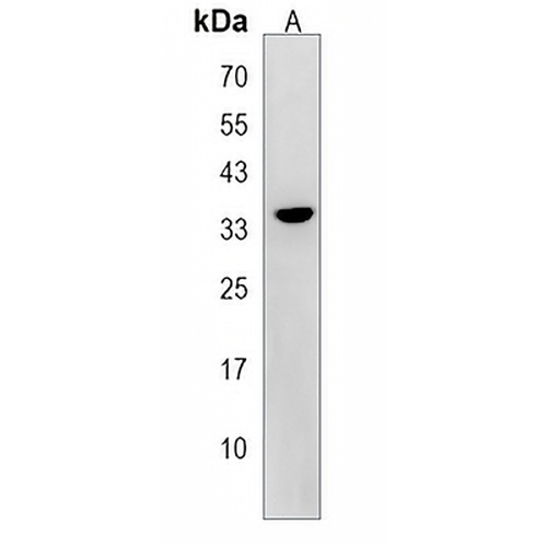 BEND6 Rabbit Polyclonal Antibody