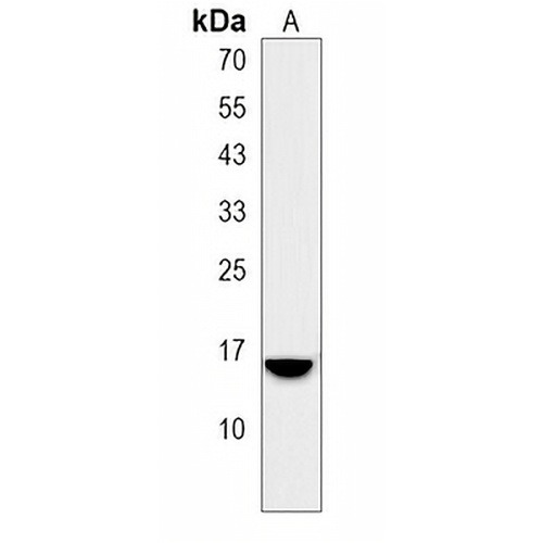 SPINK8 Rabbit Polyclonal Antibody