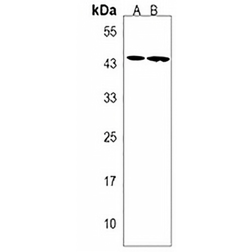 ACSM6 Rabbit Polyclonal Antibody