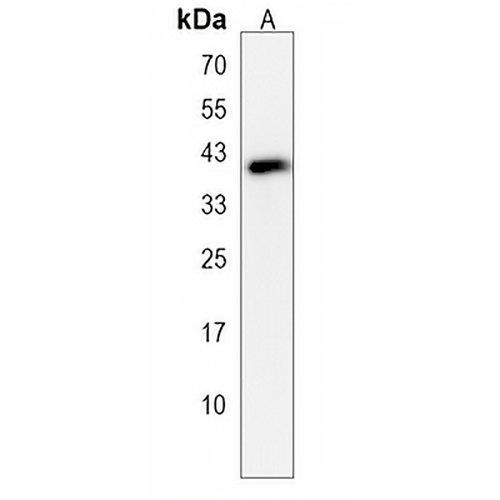 Serpin E2 Rabbit Polyclonal Antibody