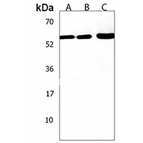 ZNF562 Rabbit Polyclonal Antibody