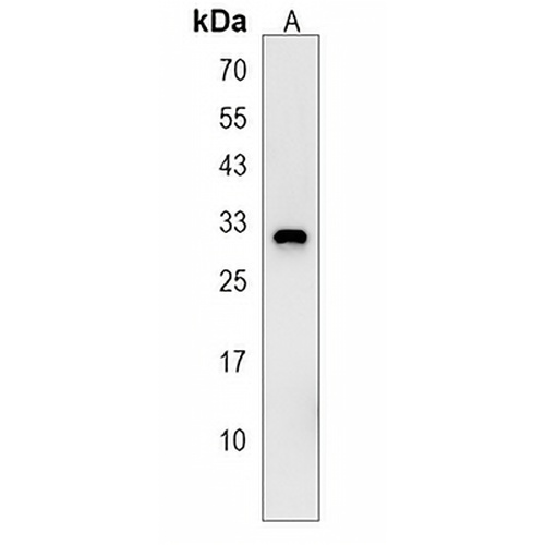 KRT222 Rabbit Polyclonal Antibody