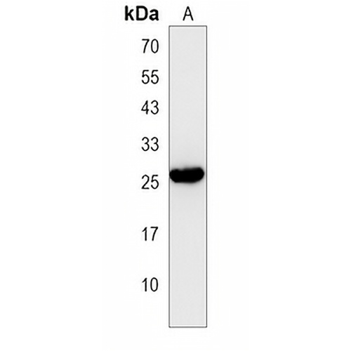 LRRN4CL Rabbit Polyclonal Antibody