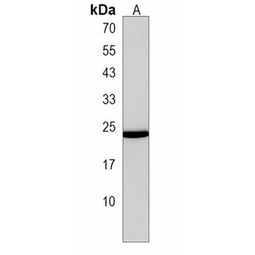 TM4SF1 Rabbit Polyclonal Antibody