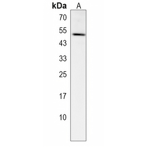 GTPBP10 Rabbit Polyclonal Antibody