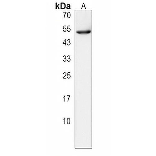 CLEC18A Rabbit Polyclonal Antibody
