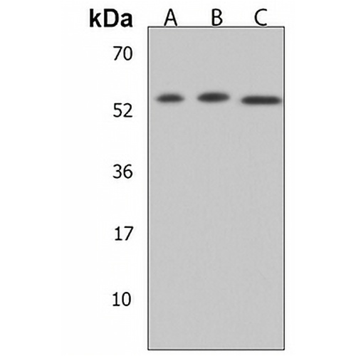 FGFR5 Rabbit Polyclonal Antibody